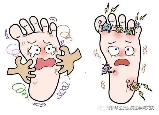 脚上怎么分辨是湿疹还是脚气,一份清晰实用的鉴别指南 脚上怎么分辨是湿疹还是脚气,一份清晰实用的鉴别指南